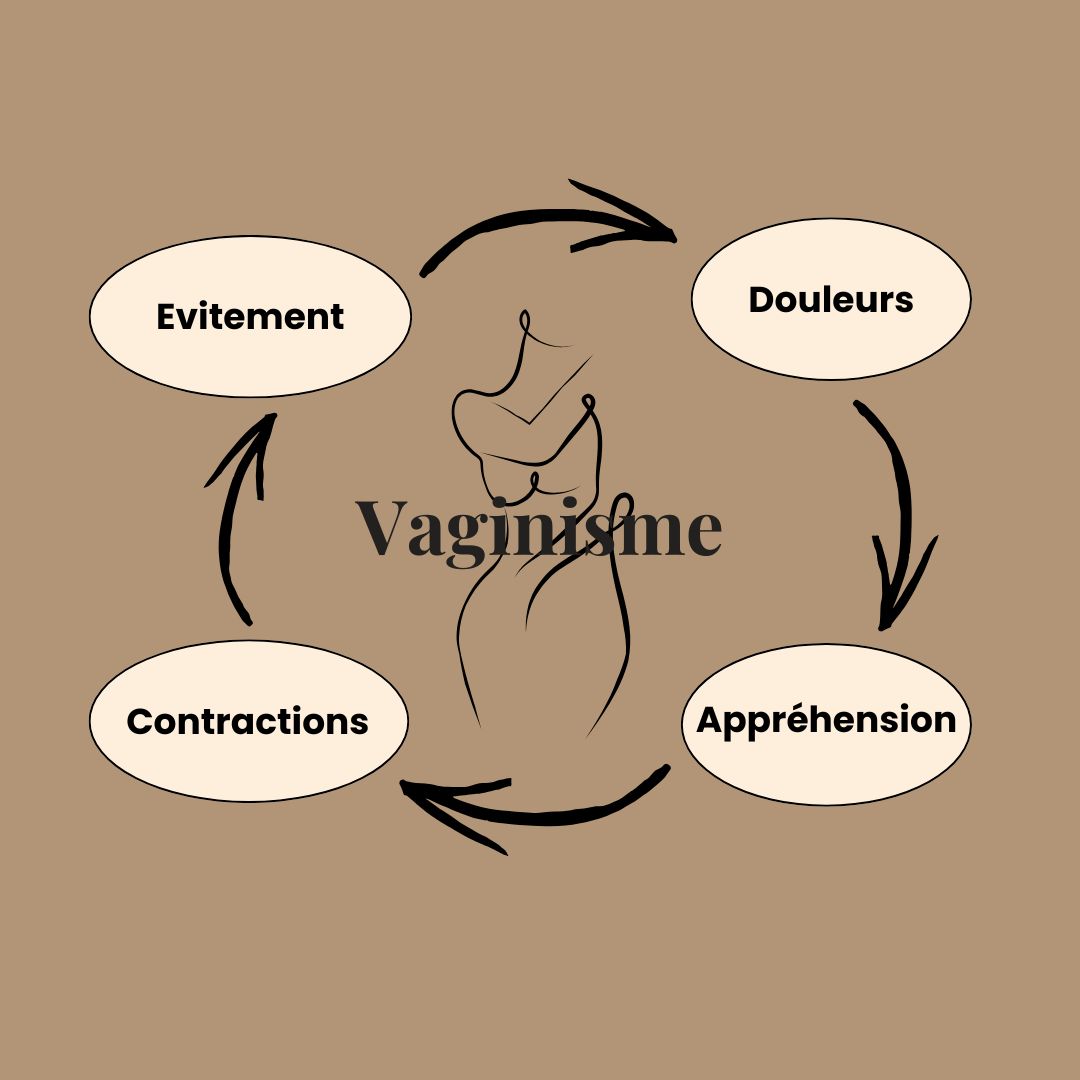 Vaginisme